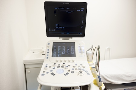 超音波検査（エコー）装置